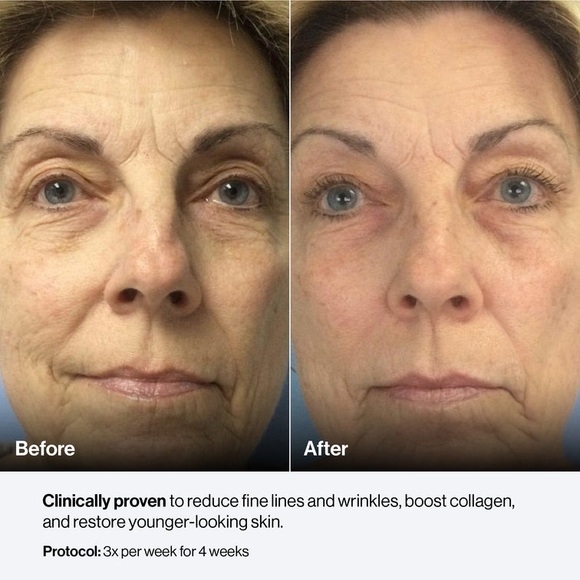 Celluma Pro + box - Picture 6 of 17